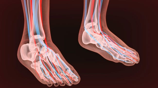Treatment Can Help Improve the Symptoms of Diabetic Neuropathy
